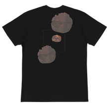 Load image into Gallery viewer, THE SPLEENIC INFARCTUS TEE